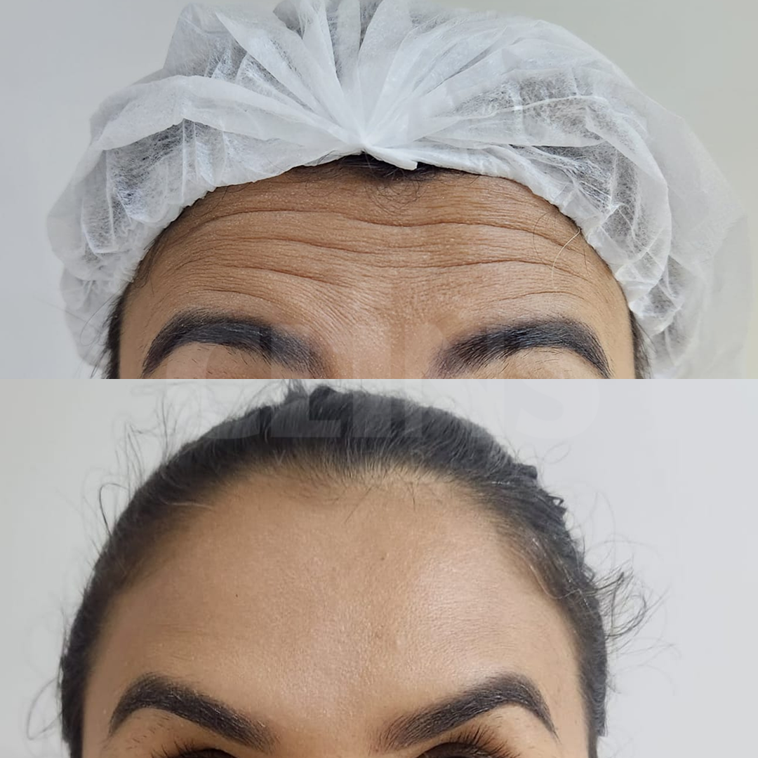 Antes e depois 10
