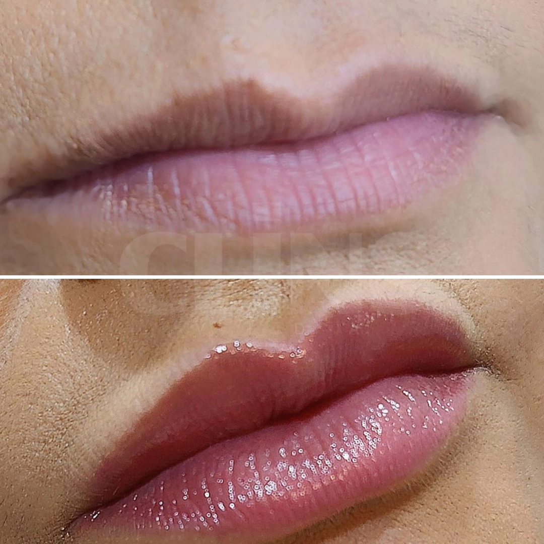 Antes e depois 13