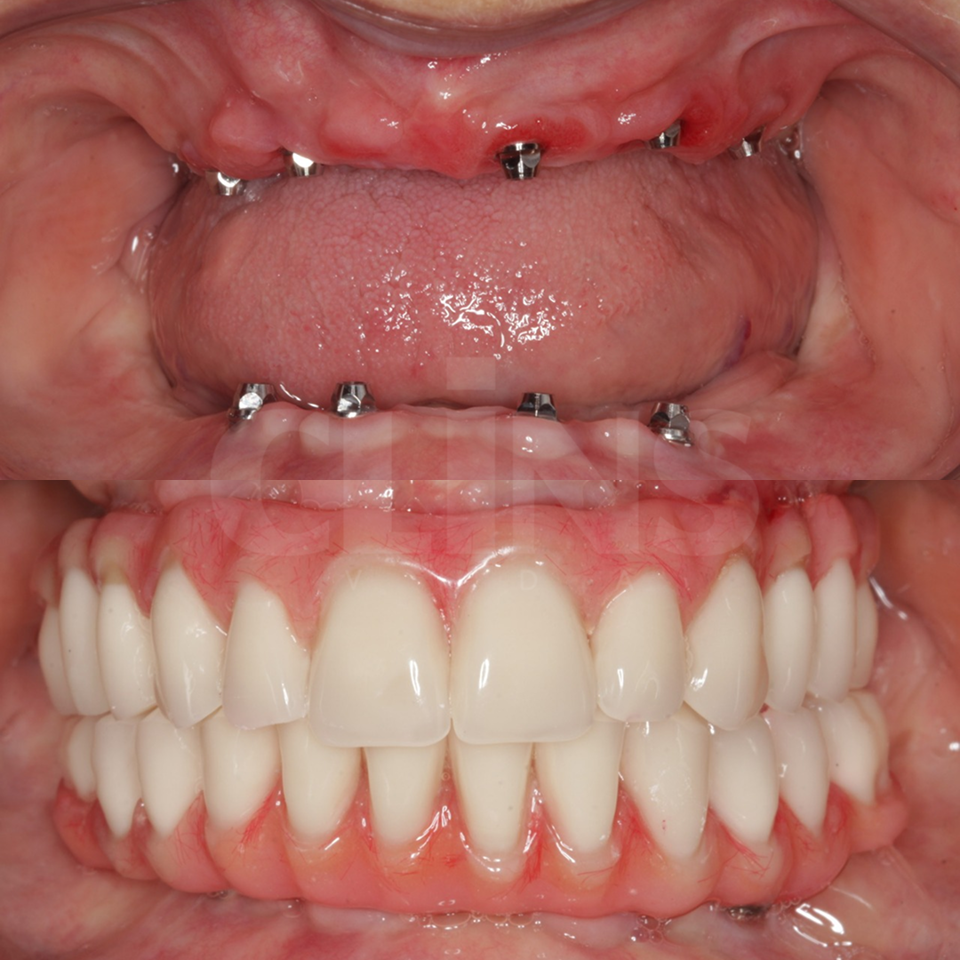 Antes e depois 9